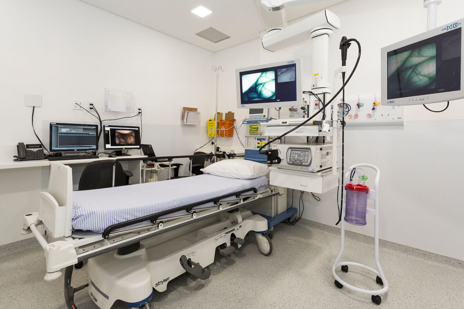 Sala de exames equipada para endoscopia digestiva e colonoscopia